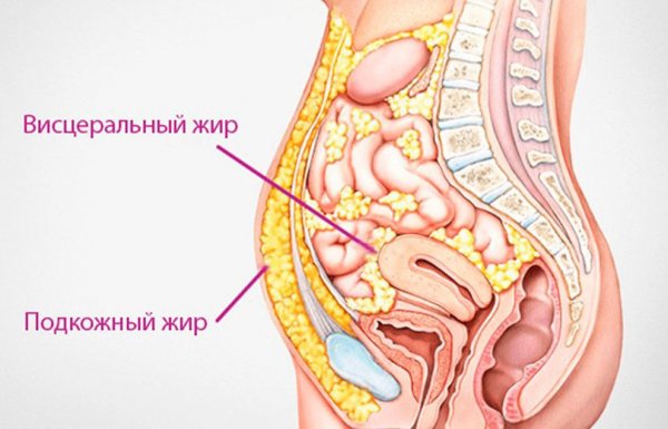 Вебинар "Висцеральный жир"